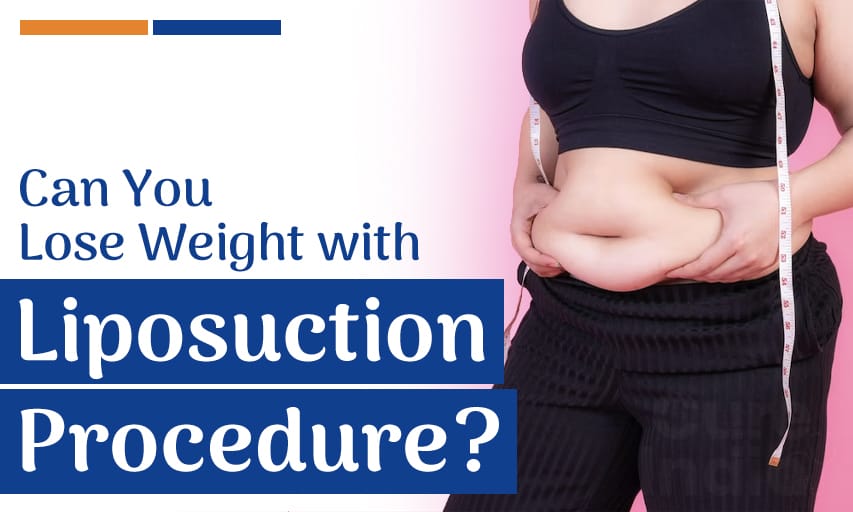 How much weight can you lose with liposuction procedure?